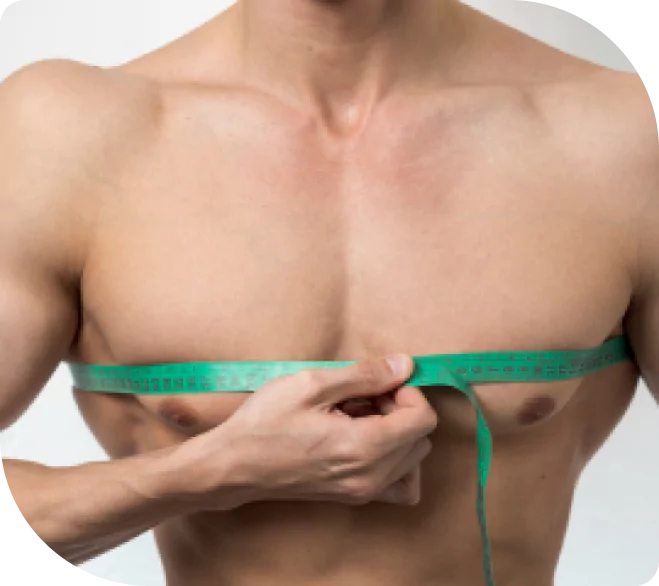 U-Lipo® Chest Tuck (Gynecomastia)