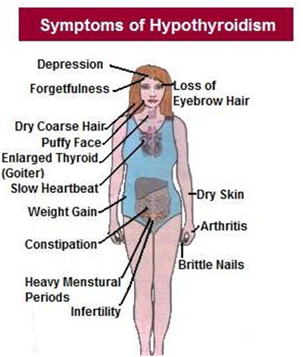 Symptoms-Of-Hypothyroidism