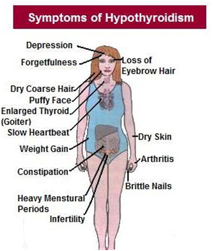 Is Your Thyroid Making You Fat