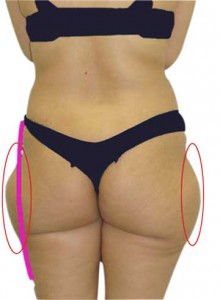 Get Rid of Saddlebags