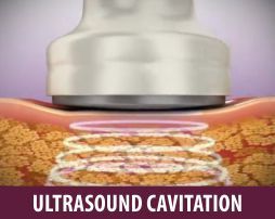 Ultrasound Caviation