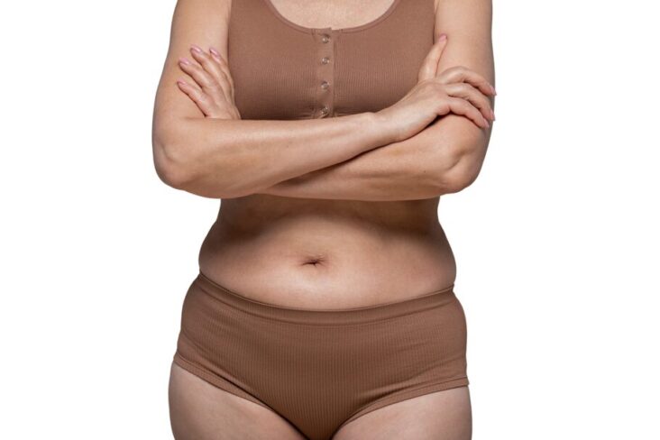 what is tummy tuck