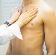 gynecomastia treatment