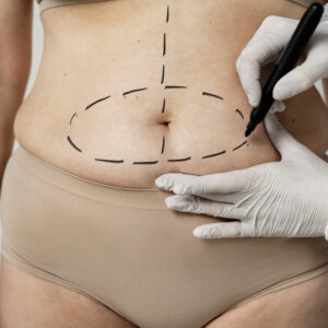 non surgical fat removal cost