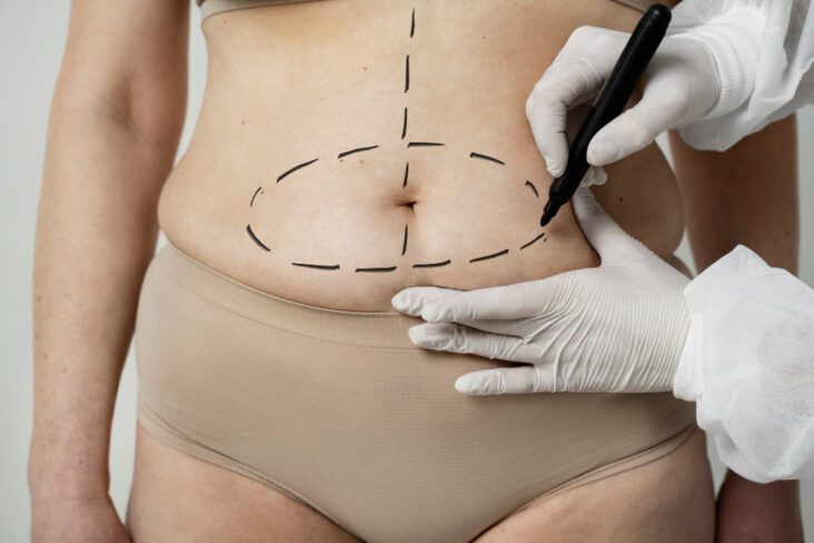 non surgical fat removal cost