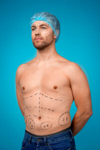 gynecomastia surgery in mumbai