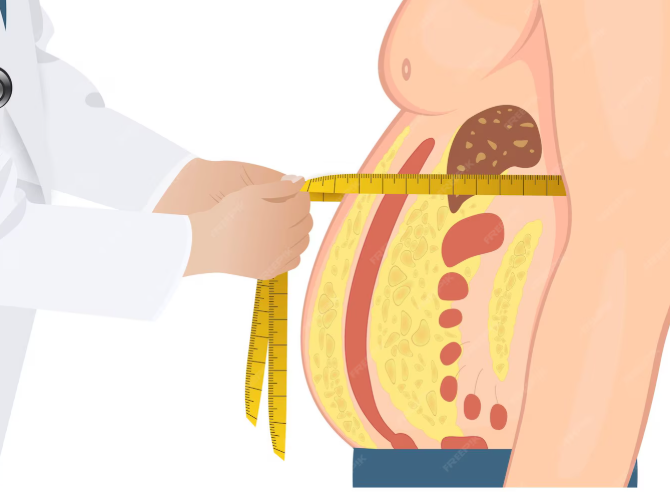 liposuction before and after