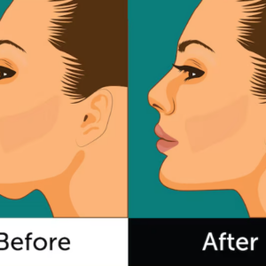 how to reduce double chin