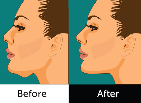 how to reduce double chin