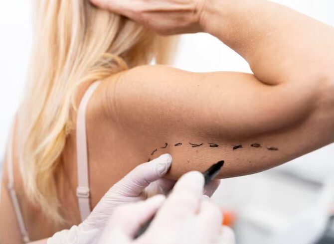 Non Surgical Arm lift in mumbai